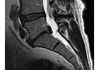 Kundenbild groß 6 Radiologie und Nuklearmedizin, MRT