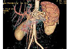 Kundenbild groß 7 Radiologie und Nuklearmedizin, MRT